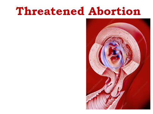 Threatened_Abortion