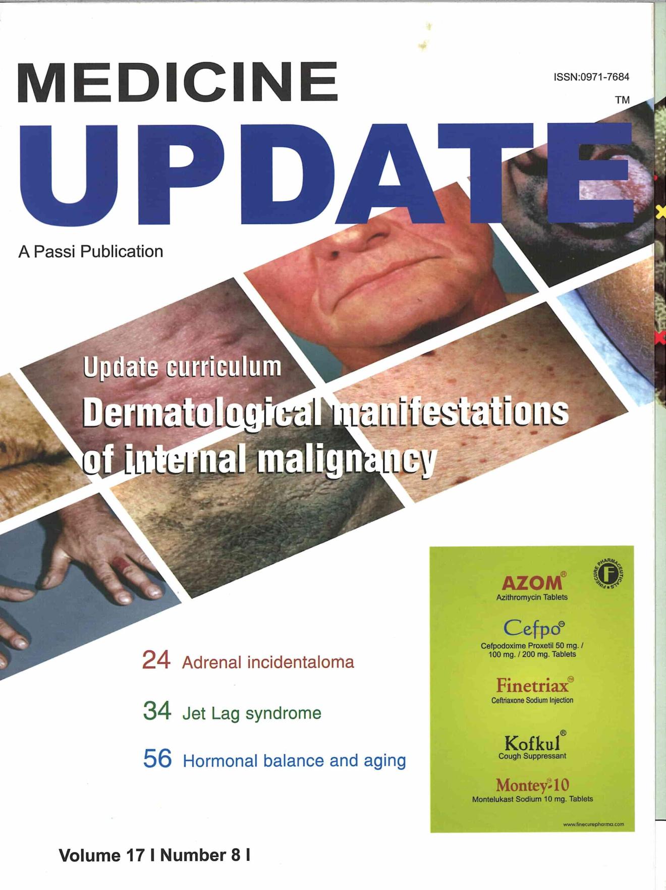 Clinical efficacy and safety of Netilmicin in the Indian population: Practitioner's perspective 